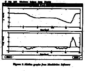 distance versus time graph and a velocity graph